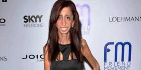 بالفيديو.. أقبح امرأة في العالم تطلق حملة تبرع لإنتاج فيلم يحكى قصتها