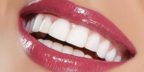 ابتسامة هوليوود.. موضة باتت حلا للكثير من مشاكل الأسنان