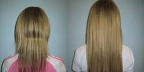 علماء ينجحون فى استنبات شعر بشرى من خلال زراعة خلايا