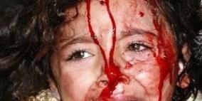 غزة: تواصل العدوان الاسرائيلي