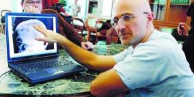 زرع رأس إنسان جراحة مثيرة للجدل