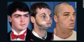 شاهد: رد فعل فتاة تشاهد لاول مره وجه شقيقها المتوفى بحادث سياره على جسد شاب اخر