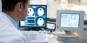 علماء: حجم دماغ الإنسان يتقلص في المساء