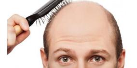 وسيلة حديثة تكافح الصلع وتجعل الشعر ينمو من جديد