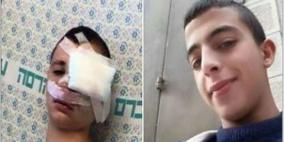 فتى مقدسي يفقد عينه اليسرى بعد إصابته بعيار مطاطي