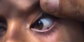 بالفيديو .. طفلة يمنية تذرف الحجارة بدل الدموع