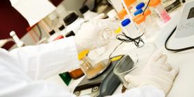 علماء الأحياء يتوصلون إلى طريقة لإطالة العمر بنسبة 30 بالمائة