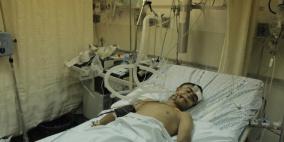 استشهاد فتى متأثرا بإصابته برصاص الاحتلال في القدس