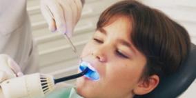 سوس الأسنان يقلل فرص الإصابة بسرطان الفم والحلق