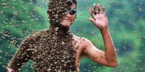 رجل ينجو من الموت بعد تعرضه إلى 1000 لدغة نحل