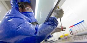 لقاح تجريبي مضاد لـ "ايبولا" يجتاز الاختبارات بنجاح