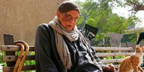 نيجيريا تؤكد إصابة 3500 مواطن بالجذام سنويا