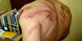 جريمة مقتل الشاب " ابو صفيه" في  بيت سيرا