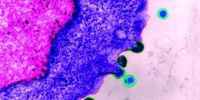 لقاح واعد للوقاية من الإيدز