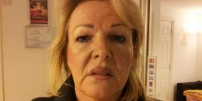 عمليات التجميل قد تتحول إلى "تشويه" بخطأ واحد