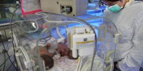 ألمانية عمرها 65 سنة تضع 4 توائم