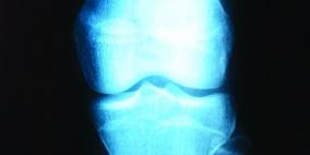 تقنية لتنمية الأعضاء مخبرياً