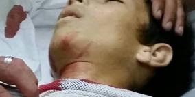 دورا تشيع جثمان الشهيد الطفل دودين