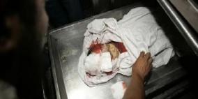 استشهاد طفل وإصابة آخر ومسن في قصف استهدف شارع النفق بغزة