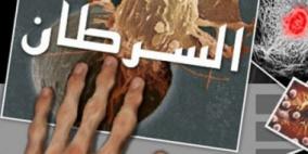 نصف سكان بريطانيا سيصابون بالسرطان