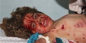 حملة دولية لملاحقة مجرمي الحرب الإسرائيليين