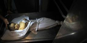 غزة: الطفلة هديل الحداد (عام ونصف)بأي ذنب قُصفت