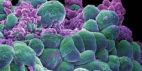 10 طرق لوقاية الرجال من الإصابة بالسرطان