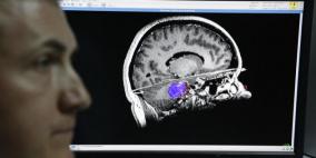 روسيا...علماء يبتكرون حاملا اصطناعيا للعقل البشري الطبيعي