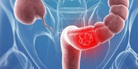 النظام الغذائي المتوازن قد يقي من سرطان الأمعاء