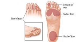 استشارى: مرض السكر يؤثر فى العظام لأنه يصيب الخلايا الغضروفية