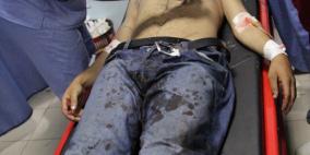 الصور الأولية لبعض الاصابات التي وصلت مجمع فلسطين الطبي من حادثه ترمسعيا