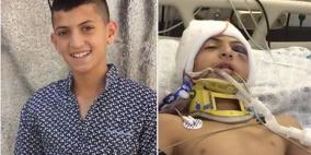 بعد استهدافه بالمطاط.. الطفل أبو الحمص مصاب بكسر في الجمجمة