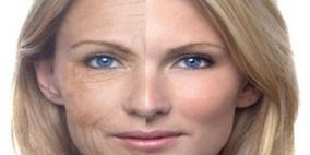 حقن البوتوكس تخفي تجاعيد وجه المرأة وتسبب ترهلات بمناطق أخرى