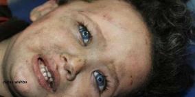 63 شهيدا في اليوم التاسع والعشرين من العدوان