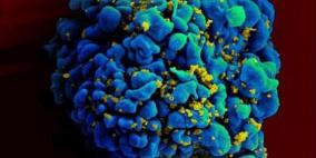 باحثون أميركيون: طفل ربما شفي من الإيدز