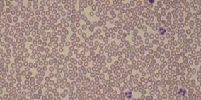 اكتشاف بكتيريا جديدة تعيش على الكافيين