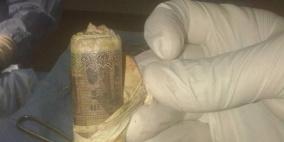 بالصور.. استخراج لفافة بها 1000 جنيه من معدة مصري