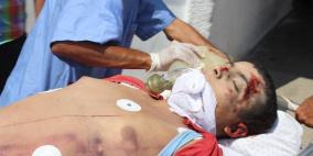 رفح: 4 شهداء و43 جريح بينهم 4 خطيرة