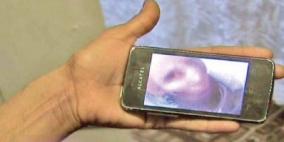 "سيلفي" من متوفاة يلف ثعبان عنقها يثير الهلع في مدينة رومانية