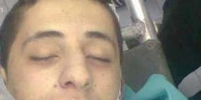 مصرع طالب جامعي بحادث دهس في طولكرم