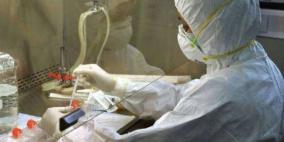 8 دول توقف استيراد الدجاج الفرنسي بسبب أنفلونزا الطيور