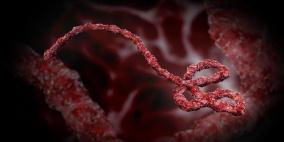 هل سيزداد عدد اصابات "ايبولا" في الولايات المتحدة؟