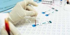 تطوير لقاح جديد لمرضى الإيدز