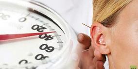 جديد من كوريا الجنوبية .. النحافة عن طريق الوخذ بالإبر في الأذن