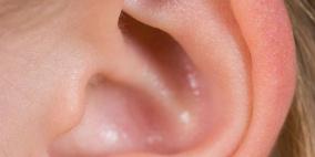 استخدام الأسبرين بكثرة قد يسبب فقدان السمع