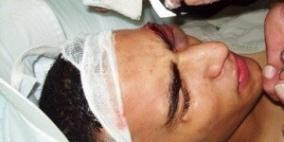 إصابات واعتقالات في مخيم شعفاط بالقدس