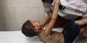 الاحتلال يبدأ اليوم بمجزرتين في رفح وخانيونس