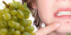 العنب هو المتسبب التاريخي الأول لحب الشباب