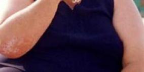 السمنة والتدخين من المسببات الأساسية للوفاة