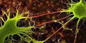 اكتشاف البروتين المسئول عن نمو الألياف العصبية التالفة
